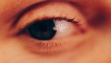 Petrol Girls – Survivor’