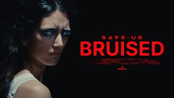 SAVE US – Bruised